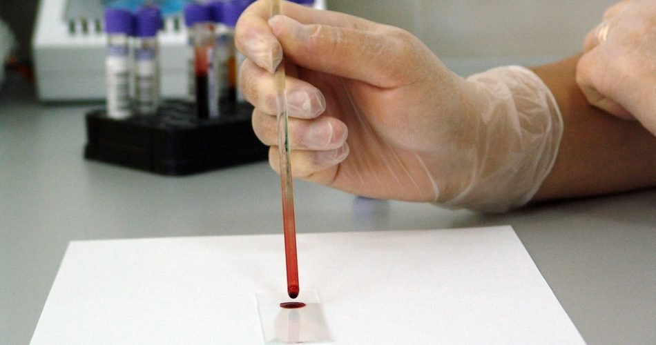 g577509126790cb371db63aeeb3aa9bc162e64f0dc64ee84acf8bf02c2911cea7968967c3e629a6cc0927e3659fa969e9_1280